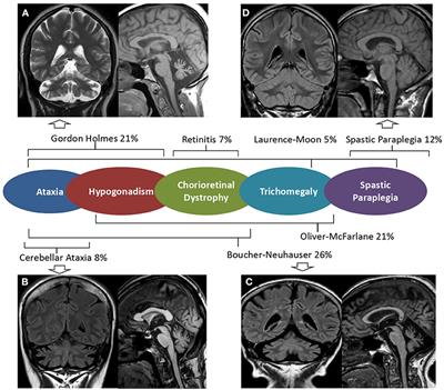 Multifaceted and Age-Dependent Phenotypes Associated With Biallelic PNPLA6 Gene Variants: Eight Novel Cases and Review of the Literature